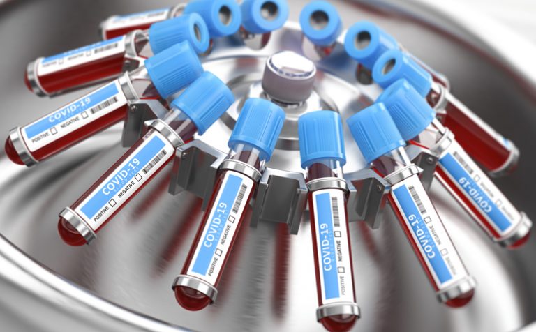 Coronavirus COVID-19 blood test samples tubes in centrifuge. Diagnostic medical laboratory. 3d illustration